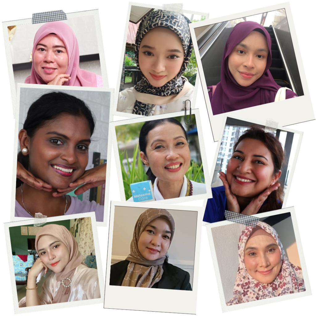 Melasma-Care-Testimoni