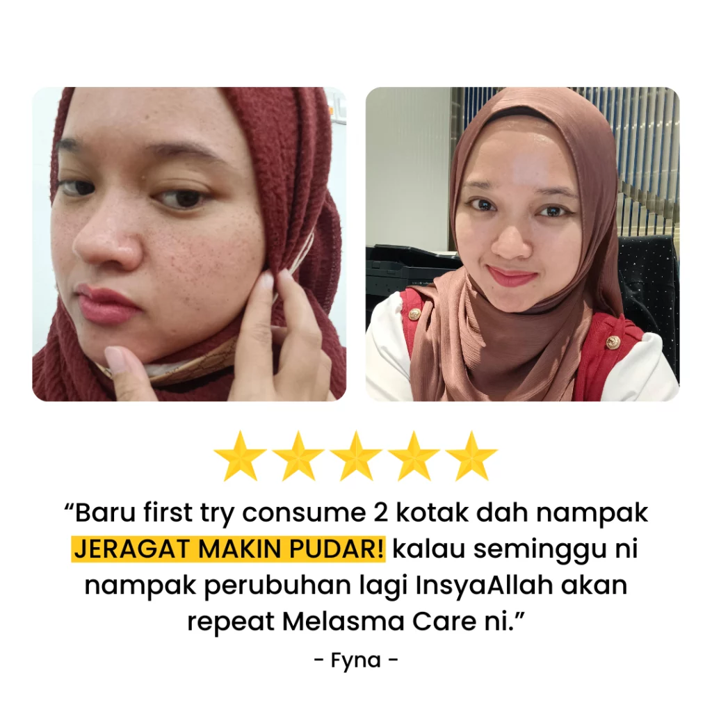 Melasma-Care-Testimoni