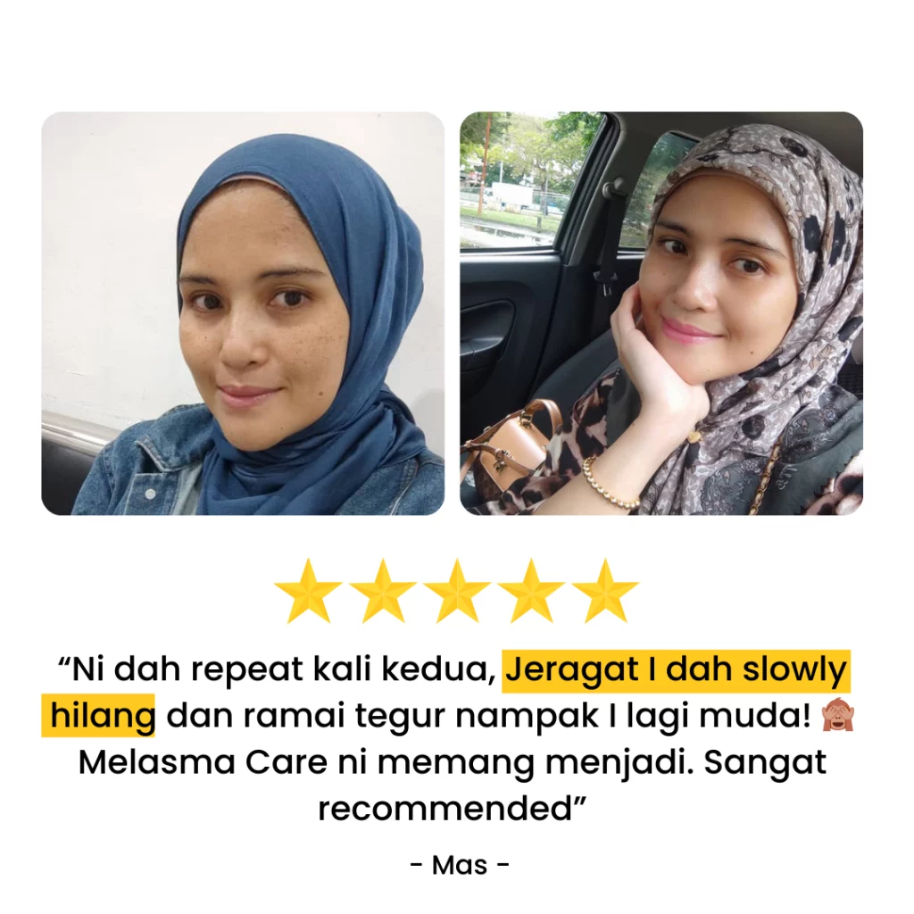 Melasma-Care-Testimoni