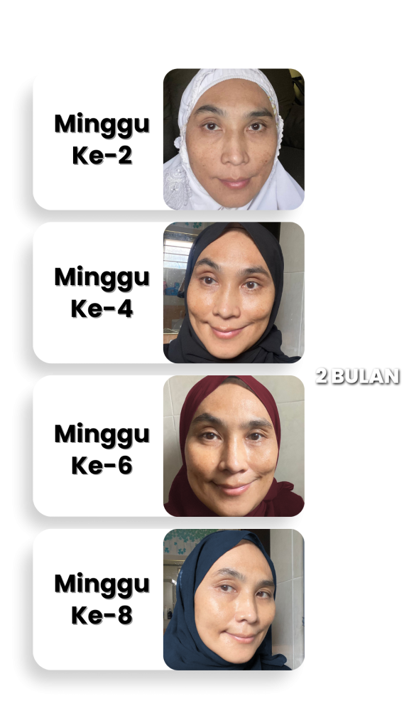 Melasma-Care-Testimoni